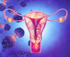 Gynaecology